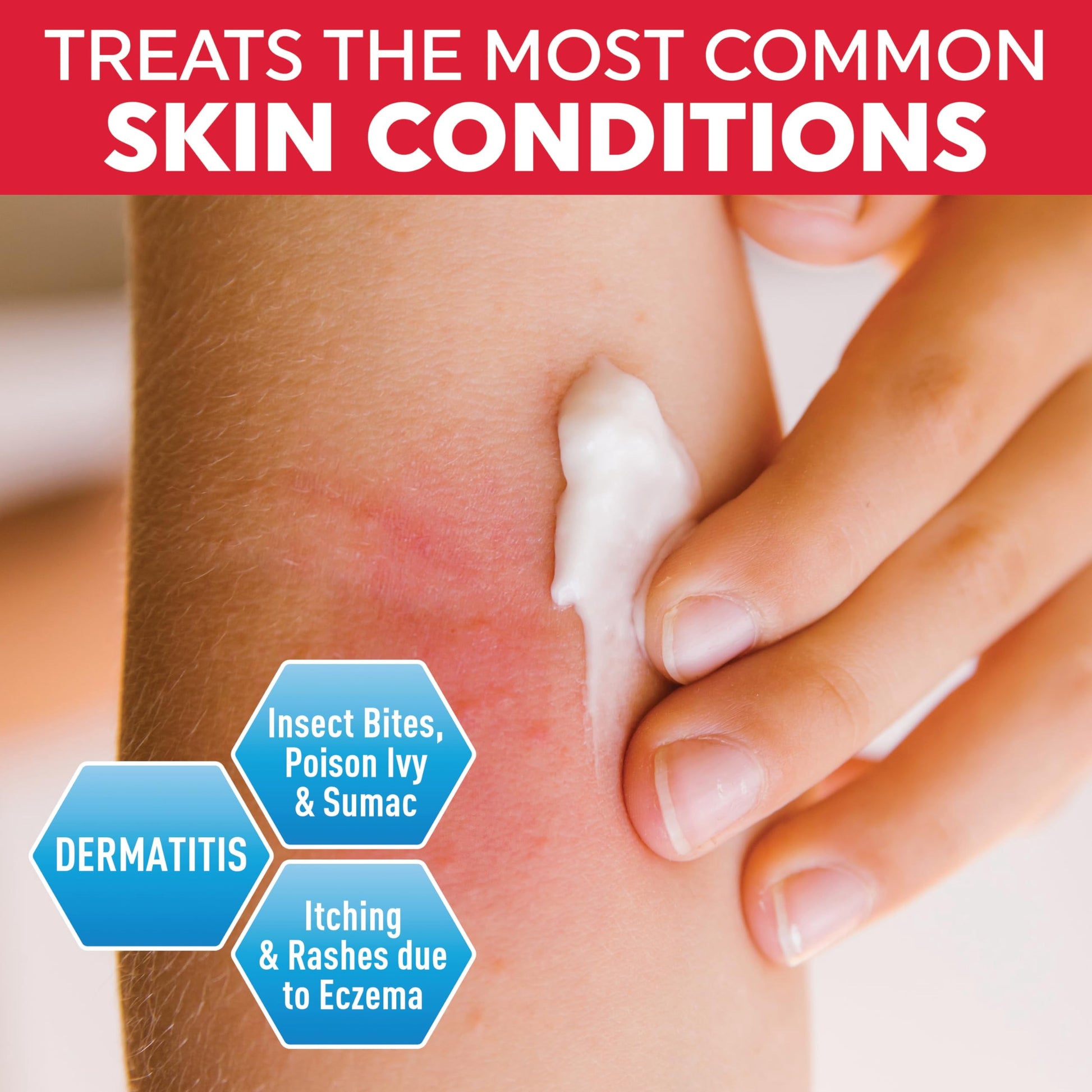 MED PRIDE 1% Hydrocortisone Cream 16Oz Bulk Cortisone anti Itch Cream for Eczema, Dermatitis, Rashes, Bug Bite Itch Relief & Skin Irritations