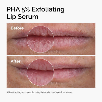 The Ordinary Lip Care Duo - Skin Care Bundle Set - PHA 5% Exfoliating Lip Serum 0.5 Fl Oz + Squalane and Amino Acids Lip Balm