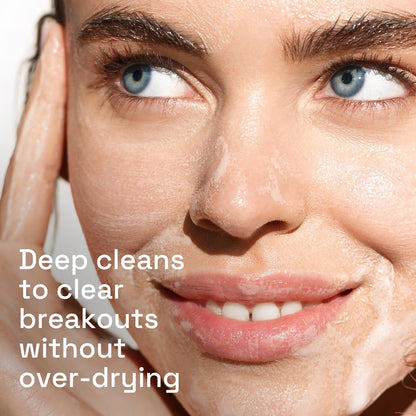 Gentle Clear Acne Face Wash, 2% Salicylic Acid, 4.2 Oz
